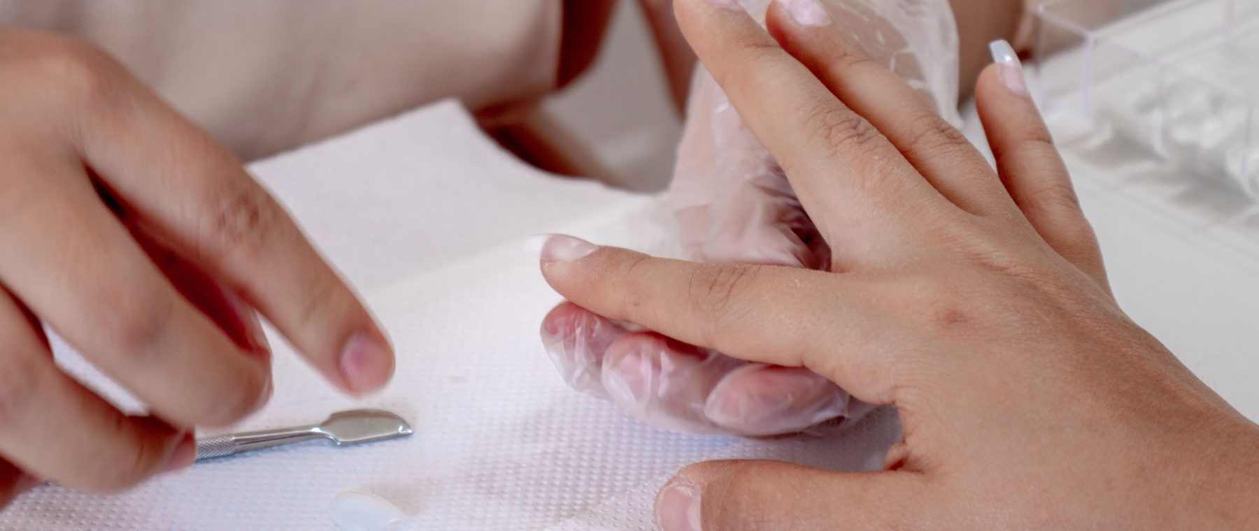 Ton ongle se décolle sans mycose, c’est quoi la cause ?