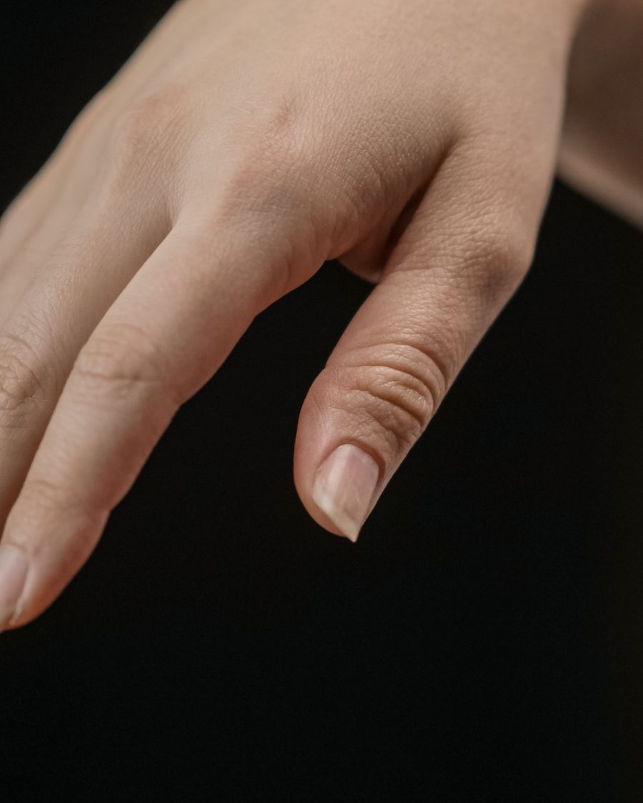 Pourquoi mes ongles sont striés et comment agir ?