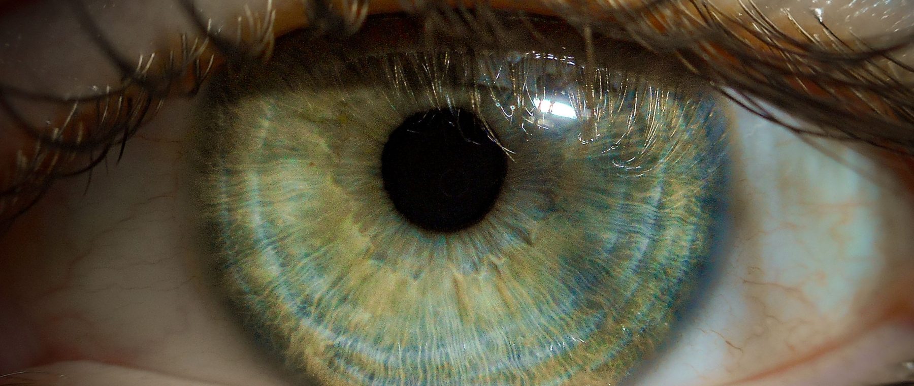 Pourquoi certaines personnes ont les yeux vert et bleu ?